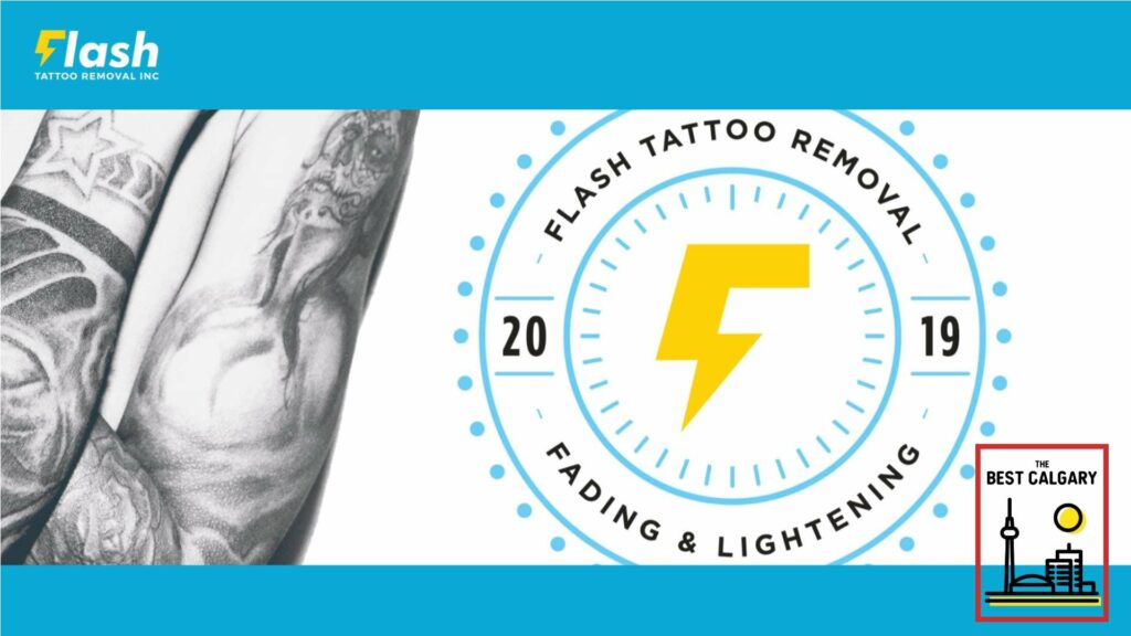 Flash Tattoo Removal