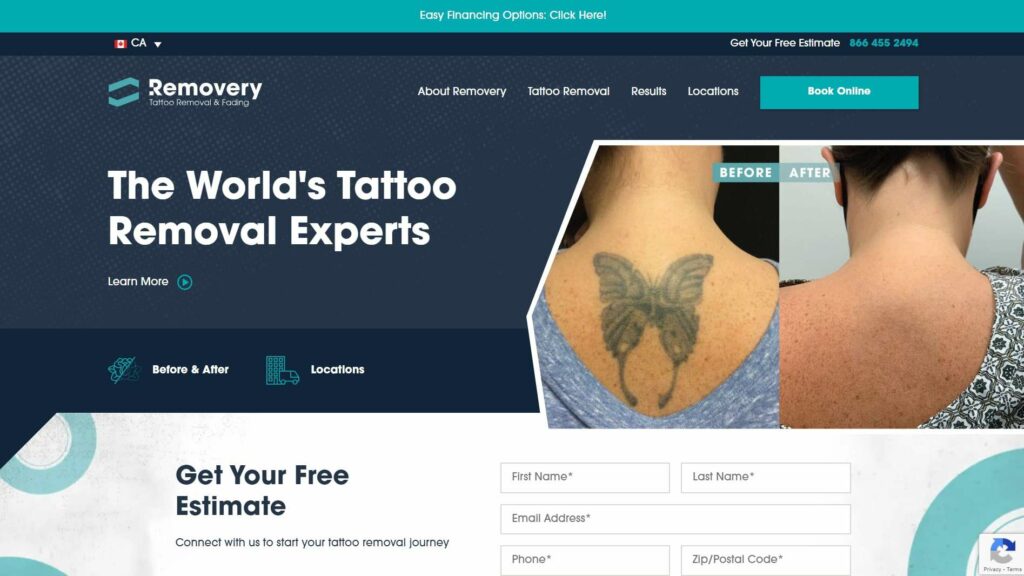 Looking for tattoo removal in Edmonton  Bush Whacked Laser