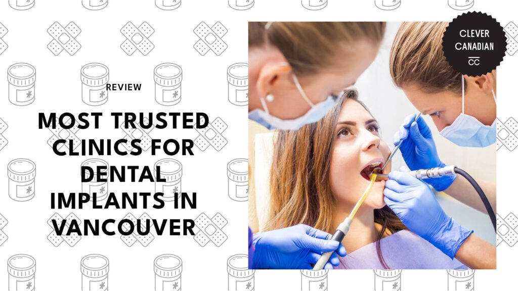 best-dental-implant-clinics-vancouver-banner