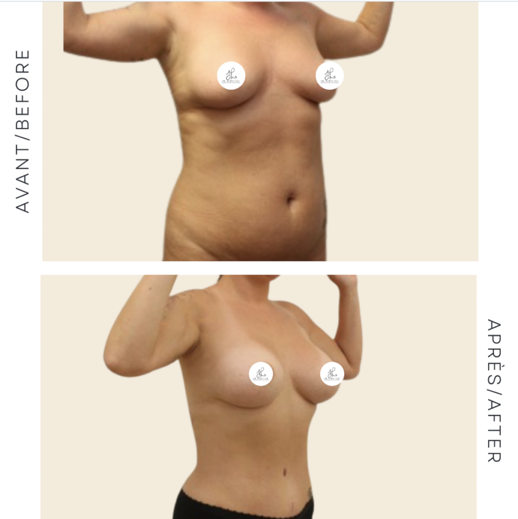 plastic-surgery