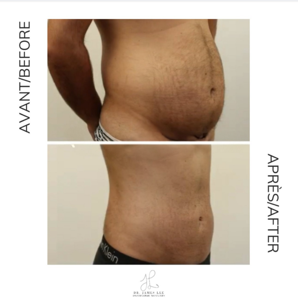 plastic-surgery-before-after